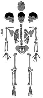 Thumbnail of Present-day bones of the skeleton of Maria Salviati (gray). Distribution of lesions (black). (Archive of the Division of Paleopathology. University of Pisa.) 