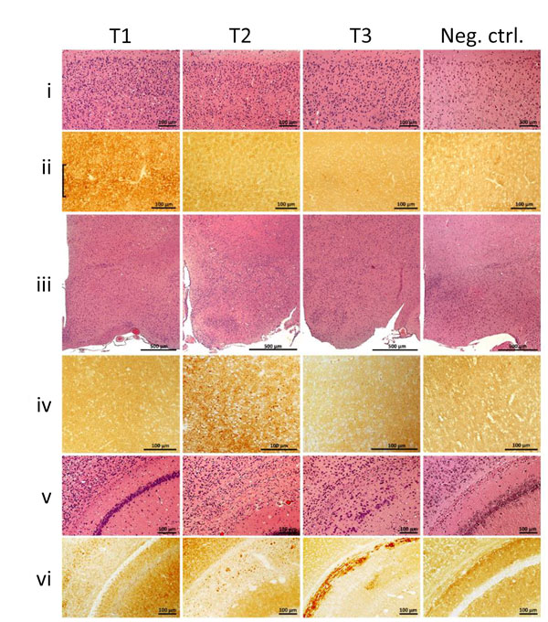 Histopathology and prion protein (PrP) immunohistochemistry images of brain regions from variably protease-sensitive prionopathy (VPSPr)–inoculated bank voles 109I harboring the histopathologic phenotypes T1, T2, or T3. For T1 bank voles, the cerebral neocortex (i, ii) shows moderate spongiform degeneration with substantial PrP immunostaining often displaying a laminar enhancement (bracket), but spongiform degeneration and PrP immunostaining were minimal or lacking in T2 and T3 bank voles (i, ii