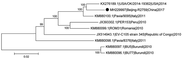 Phylogenetic tree of EV-C105 from a patient in Beijing, China (black dot) and reference isolates from different locations. We estimated the phylogenetic relationships of complete or near-complete EV-C105 genomes using the neighbor-joining method with 1,000 replicates bootstrapped by using MEGA version 6.06 software (http://www.megasoftware.net). Numbers along branches indicate bootstrap percentages. Isolates are identified by GenBank accession number, strain name, location, and year. Scale bar i