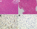 Thumbnail of Histologic and immunohistochemical staining of liver tissue from a 56-year-old man at Queen Mary Hospital, Hong Kong. A, B) Liver tissue sections (original magnification ×200) stained with hematoxylin and eosin obtained at day 0 (A), showing normal hepatocyte architecture, and day 98 (B) after transplant showing progressive increase in hepatocyte ballooning and degenerative changes. C, D) Liver tissue section stained with cross-reactive monoclonal antibody (original magnification ×4