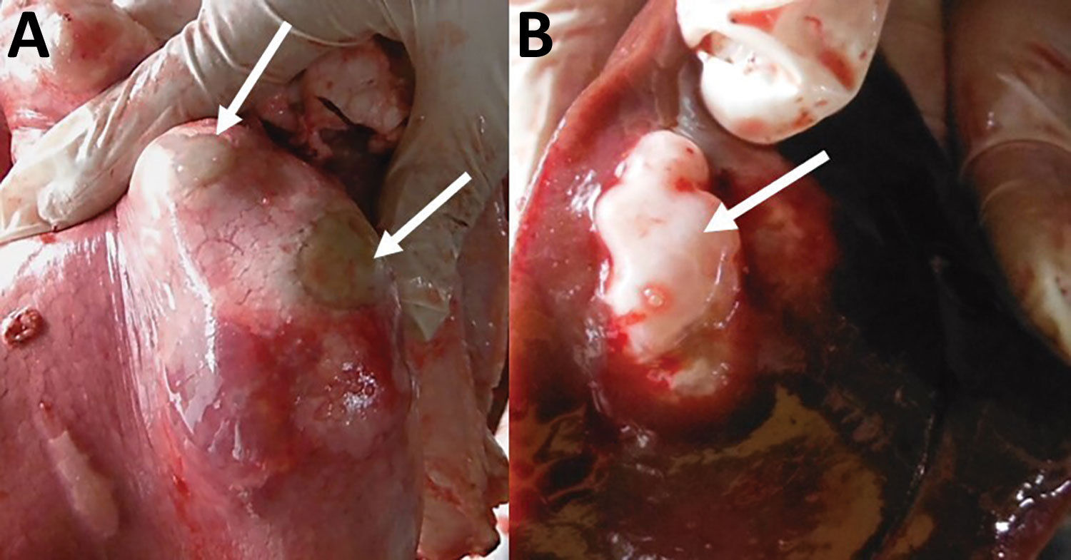 Lung (A) and liver (B) parenchyma infected with hydatid cysts (white arrows) detected during veterinary inspection at slaughterhouse and before the entire organ was confiscated and destroyed by incineration, Huancayo Province, Peru.