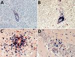 Thumbnail of Demonstration of neutrophils, B cells, and CD4+ and CD8+ T-lymphocyte infiltration of the brain parenchyma during variegated squirrel bornavirus 1 infection. A) Demonstration of CD177+ neutrophils infiltrating the brain parenchyma from a blood vessel. Neutrophils are also seen scattered throughout the tissue during the infection. Immunoperoxidase stain with hematoxylin counterstain; original magnification ×200. B) Depiction of B cells (CD20, blue) and T cells (CD3, red) around a blo