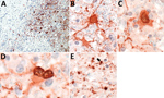 Thumbnail of Presence of variegated squirrel bornavirus 1 (VSBV-1) antigen in neurons, astrocytes, and oligodendrocytes. A) Widespread presence of VSBV-1 antigen in brain tissue. Endothelial cells show no viral antigen. Immunoperoxidase stain with hematoxylin counterstain; original magnification ×200. B, C) Demonstration of VSBV-1 antigen in neurons. Immunoperoxidase stain with hematoxylin counterstain; original magnification ×600. D) VSBV-1 antigen in an astrocyte. Immunoperoxidase stain with h
