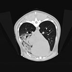 Thumbnail of Transverse computed tomography of dog with pneumonic plague on day 2 of hospitalization, Colorado, USA. Image shows accessory lobar consolidation.