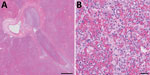 Thumbnail of Histopathologic analysis of accessory lung lobe of dog with pneumonic plague (hematoxylin and eosin stain), Colorado, USA. A) Parenchyma, which is diffusely effaced by necrohemorrhagic pneumonia. Scale bar indicates 500 μm. B) Alveolar detail, which is obscured by necrosis, hemorrhage, and suppurative inflammation without intralesional bacteria. Scale bar indicates 20 μm.