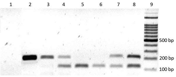 Detection of Plasmodium spp. in blood samples by gel electrophoresis on a 2% agarose gel, Venezuela. DNA amplicons generated by nested PCR of the DNA extracted from malaria parasites in blood samples from patients. Lane 1, negative control; lanes 2 and 3, P. falciparum–infected samples; lanes 4 and 7, mixed infection (P. falciparum + P. vivax) samples; lanes 5 and 6, P. vivax–infected samples; lane 8, mixed positive controls of P. falciparum (205 bp) and P. vivax (120 bp); lane 9, 100-bp ladder 