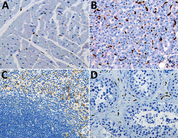Double immunohistochemical staining of Ebola virus (red) and CD163 antigen (brown) in tissues of patients who died of noninfectious causes. CD163 antigens in macrophages of heart (A), liver (Kupffer cells) (B), spleen (C), and testicle (D). Original magnification ×20.