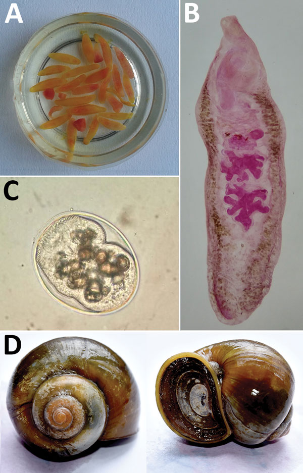 Artyfechinostomum sufrartyfex trematodes isolated from infected patients in Bihar, India. A) Trematodes in physiologic saline collected from stool samples. B) Whole mount of an adult trematode (acetocarmine stain). C) Metacercaria isolated from Pila globosa snails. Original magnification ×400. D) Pila globosa snails, the second intermediate host of the trematode.