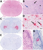 Thumbnail of Histologic and in situ hybridization findings in cervical segment 7 of the spinal cord of 3-week-old lamb in Scotland in study of picornavirus in lambs with severe encephalomyelitis. A) Segment view with hematoxylin and eosin stain under low power. B) Hematoxylin and eosin stain under high powerNonsuppurative myelitis is oriented on the ventral horn involving neuronal degeneration with satellitosis (black arrow), neuronophagia (arrowhead), and glial nodule formation (blue arrow), ac