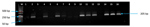 Thumbnail of Screening PCR results of persons with Plasmodium falciparum parasite infections, North Central Nigeria, 2015–2018. Lane M, 50-bp DNA marker (ThermoFisher Scientific, https://www.thermofisher.com); lanes 1–4, archived blood samples from Nisa Premier Hospital (Jabi, Federal Capital Territory, Nigeria); lanes 5–15, archived blood samples from Kogi Specialist Hospital (Lokoja, Kogi State, Nigeria); lane 16, positive control. Samples positive for P. falciparum had a PCR product size of 2