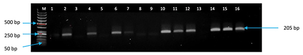 Screening PCR results of persons with Plasmodium falciparum parasite infections, North Central Nigeria, 2015–2018. Lane M, 50-bp DNA marker (ThermoFisher Scientific, https://www.thermofisher.com); lanes 1–4, archived blood samples from Nisa Premier Hospital (Jabi, Federal Capital Territory, Nigeria); lanes 5–15, archived blood samples from Kogi Specialist Hospital (Lokoja, Kogi State, Nigeria); lane 16, positive control. Samples positive for P. falciparum had a PCR product size of 205 bp.