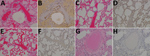 Thumbnail of Results of testing for Nipah virus (NiV) in lung tissue from representative vaccinated African green monkeys (Chlorocebus aethiops). A, C, E, G) Hematoxylin and eosin staining; B, D, F, H) immunohistochemistry of tissues labeled with NiV N protein–specific polyclonal rabbit antibody. In stained tissue from the control animal (A), diffuse thickening of alveolar septae by moderate numbers of lymphocytes, plasma cells, polymerized fibrin, and edema fluid within the alveolar spaces were