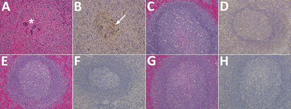 Results of testing for Nipah virus (NiV) in spleen tissue from representative vaccinated African green monkeys (Chlorocebus aethiops). A, C, E, G) Hematoxylin and eosin staining; B, D, F, H) immunohistochemistry of tissues labeled with NiV N protein–specific polyclonal rabbit antibody. In stained tissue from the control animal (A), moderate necrosis and drop of out the white pulp (*), with hemorrhage, and fibrin within germinal centers are seen; stained sections examined from the NiV F (C), NiV 