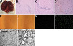Thumbnail of Pathologic examination and virus culturing of brain tissue samples from 2 seals with lethal encephalitis infected with Japanese encephalitis virus (JEV), China, 2017. A) Hemorrhaging seal brain. B) Histochemical staining of a glial nodule in the cerebrum showing lymphocyte infiltration around small blood vessels. Scale bar represents 50 μm. C) Histochemical staining of tissue showing coalescing nonsuppurative encephalitis with neuronal degeneration and perivascular cuffing. Scale ba