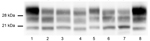 Thumbnail of Bovine-PrP transgenic mice challenged with atypical BSEs transmitted into human-PrP transgenic mice before and after adaptation to sheep-PrP sequence in a study of atypical BSE transmission using isolates from different countries in Europe and transgenic mouse models overexpressing human normal brain prion protein. Brain PrPres in TgBo mice inoculated with different atypical BSE either before or after passage into the different transgenic lines. L-BSE biochemical profile (lane 2) ch