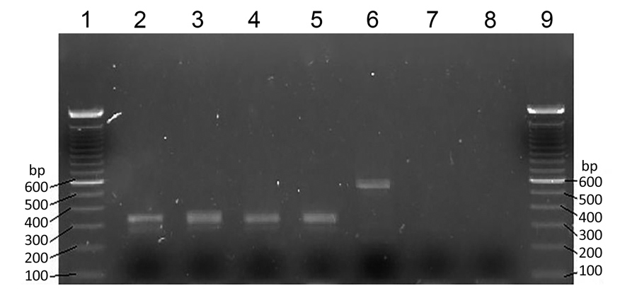 Nested PCR amplification products for Mansonella ozzardi microfilariae obtained from archived human samples in the Amazon region of Ecuador. Samples were subjected to electrophoresis on a 2% agarose gel. Lanes 1 and 9, 100-bp molecular mass ladders; lanes 2, 3, 4, and 5, M. ozzardi nematode-positive samples (sample nos. 14, 53, 27, and 25, respectively) that yielded a 305-bp fragment; lane 6, Toxocara canis roundworm (610-bp fragment); lane 7, M. ozzardi nematode–negative thick blood smear; lane