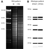 Thumbnail of Comparison of the molecular characteristics of Clostridioides difficile strain DQ/591 and the epidemic BI/027 strain in study of C. difficile at 2 US Veteran Affairs long-term care facilities and their affiliated acute care facilities. The HindIII REA (A) and PCR ribotype (B) banding patterns were distinct between REA strain DQ/RT591 and REA strain BI/RT027. Molecular weight markers (in kb) are shown adjacent to the REA gel pattern. An internal spiked LIZ 1200 standard was used for 