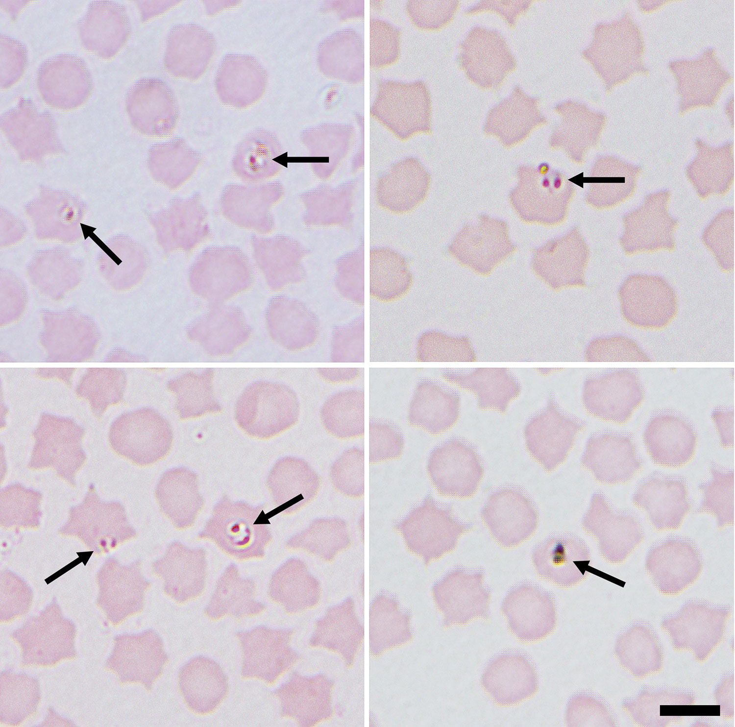 Representative images of small intracellular Babesia (arrows) identified in sheep erythrocytes from several sites in northeastern Scotland, UK. Both paired piroforms and ring forms are visible. Images were taken at ×1,000 magnification with oil immersion. Scale bar indicates 5 μm.