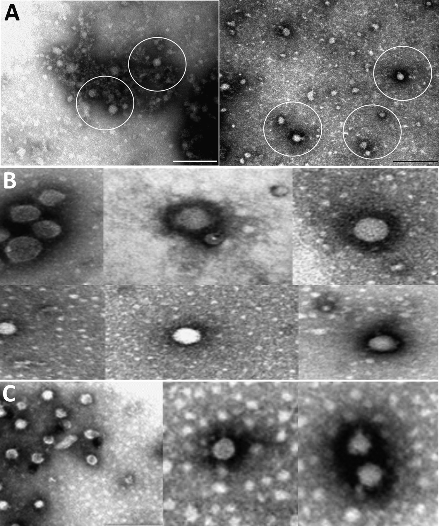 Electron microscopy of Bagaza virus isolated in samples from Himalayan monal pheasants, South Africa, 2016–2017. A) Circles indicate occasional particles with size range and approximate morphology of Flaviviridae observed in samples ZRU350_17_1 and ZRU350_17_2. Scale bars indicate 200 nm. B) A few isolated fringed isometric particles of 40–65 nm (top row) and free-lying smooth-surfaced particles of 25–40 nm (bottom row) of suspected Flaviviridae observed in sample ZRU349_17_6. C) A few free-lyin
