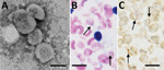 Thumbnail of Morphologic features of Candidatus Mycoplasma haemohominis isolated from a serum sample of a 42-year-old man, Japan. A) Spheres are bacterial particles with a diameter of 300–600 nm. Negative stained; scale bar indicates 200 nm. B) Bacteria on the surface of erythrocytes (arrows in the left panel). In situ hybridization showing bacteria on the surface of erythrocytes (arrows in the right panel). Giemsa stained; scale bar indicates 10 μm.