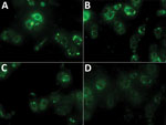 Thumbnail of Indirect immunofluorescence assay results for Crimean-Congo hemorrhagic fever virus for 4 samples from humans that were positive by ELISA, Pakistan, 2016–2017. A, B) Samples at 1:100 dilution. C, D) Samples at 1:20 dilution.