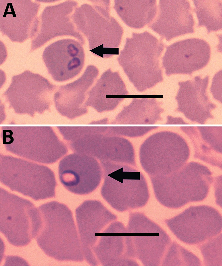 Piriform (A) and ring shapes (B) in blood smear of sample taken from patient with Babesia crassa–like infection, Slovenia, 2014. Smear was Wright-Giemsa stained. Scale bars indicate 50 μm.