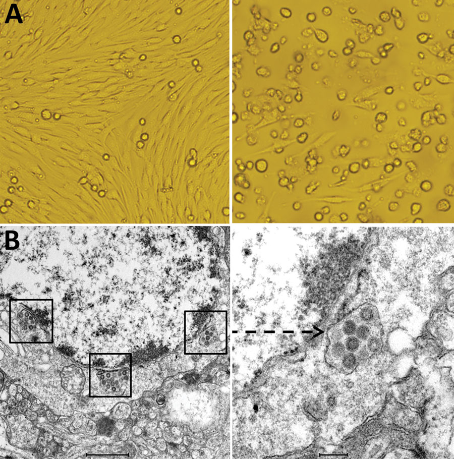 Cytopathogenic effect and electron microscopic morphology of baby hamster kidney 21 (BHK-21) cells infected with phlebovirus (, China. A) Left panel shows morphology of BHK-21 cells before inoculation with strain SXWX1813-2; right panel shows morphology 3 days after inoculation. BHK-21 cells infected with SXWX1813-2 showed reduced adherence and a large number of rounded and exfoliated cells. B) Left panel shows the viral morphology of SXWX1813–2 on ultrathin slices; right panel shows the enlarge