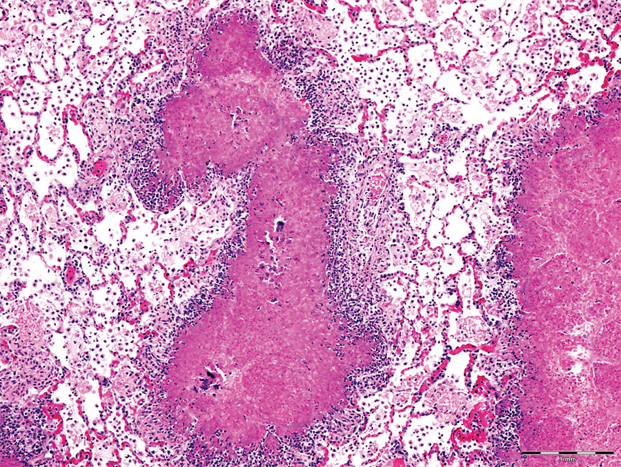 Histologic lung lesions in free-ranging pronghorn, characterized by caseonecrotic foci centered on residual bronchioles, Wyoming, USA, February–April 2019. Alveolar fibrin exudation and suppurative to mixed inflammation throughout. Scale bar indicates 1 mm.