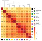 Thumbnail of Correlations of intensities of individual symptoms (379 surveys, 79 participants) and hierarchical clustering for participants tested for heterogeneity of dengue illness in community-based prospective study, Iquitos, Peru. Tile colors indicate strength of correlations. The height at which symptoms are linked in the dendrogram indicates how strongly they are related (lower height indicates a closer link)