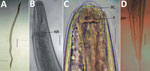 Thumbnail of Microscopic images of Oxyspirura larvae collected from an infected patient, Vietnam. A) Whole body of Oxyspirura larvae; B, C) larvae anterior; D) larvae posterior. Scale bars indicate 100 μm in panel A, 50 μm in panels B–D. AN, anus; BC, buccal cavity; NR, nerve ring; P, papilla.