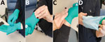 Thumbnail of Depiction of improper protocol for doffing gloves the case-patient reported using while conducting a protocol for growth and purification of high-titer dengue virus, United States, 2018. The red X indicates the location of an open wound on the ring finger of the case-patient’s left hand.