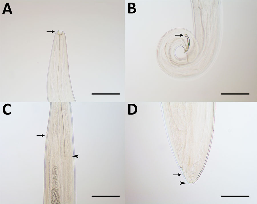 Thelazia callipaeda eyeworms collected from animals in China in study of ectoparasites and vectorborne zoonotic pathogens of dogs and cats in Asia, 2017–2018. A) T. callipaeda male eyeworm with buccal capsule (arrow); B) posterior end of male eyeworm with short and crescent-shaped spicule (arrow); C) anterior portion of T. callipaeda female eyeworm with vulva (arrow) located posterior to the esophagus-intestinal junction (arrowhead); and D) posterior end of female eyeworm showing anus (arrow) an