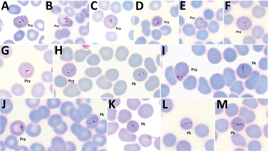 Plasmodium cynomolgi and P. knowlesi parasites in patient K199, admitted to Kapit Hospital with malaria during June 24, 2013–December 31, 2017, Malaysian Borneo. A–G) Early trophozoites of P. cynomolgi within enlarged and, at times, distorted erythrocytes, with Schüffner’s stippling and single, double, or triple chromatin dots. H–J) Early trophozoites of P. knowlesi and P. cynomolgi. K–M) Band form trophozoites of P. knowlesi. Pcy, P. cynomolgi; Pk, P. knowlesi. Magnification ×100.