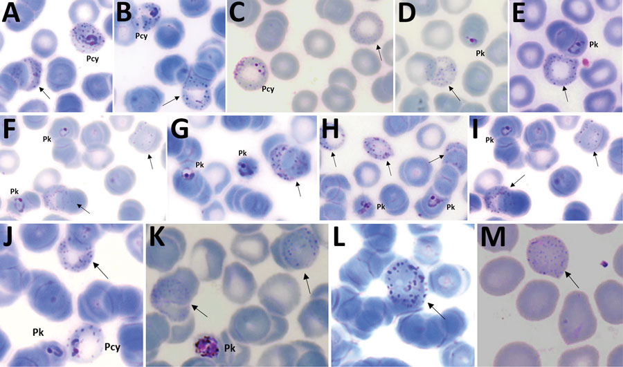 Plasmodium cynomolgi and P. knowlesi parasites in patient K07, admitted to Kapit Hospital with malaria during June 24, 2013–December 31, 2017, Malaysian Borneo. Arrows indicate Schüffner’s stippling in erythrocytes without parasites. A–C) Early trophozoites of P. cynomolgi; D–I) early trophozoites of P. knowlesi; J) early trophozoites of P. knowlesi and P. cynomolgi; K) gametocyte of P. knowlesi. Pcy, P. cynomolgi; Pk, P. knowlesi. Magnification ×100.