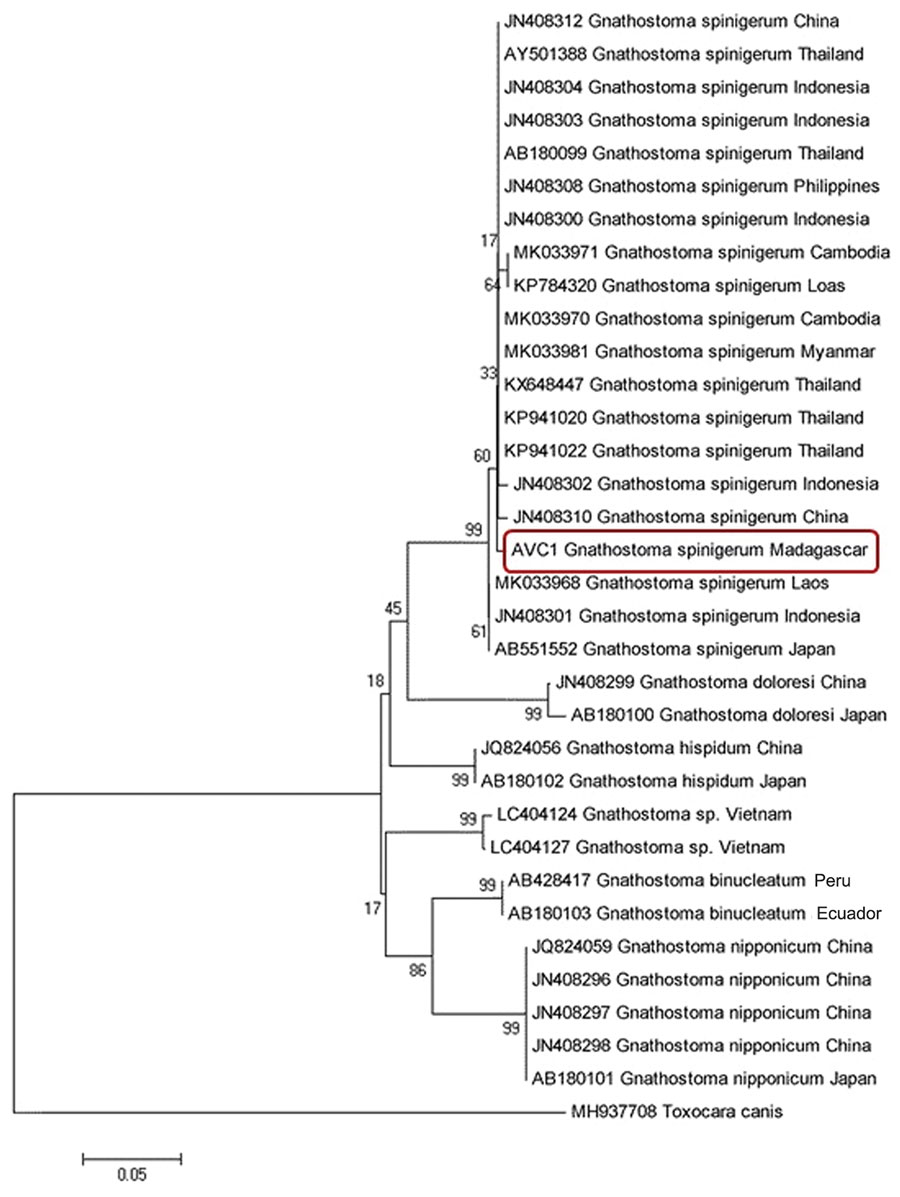 Neighbor-joining phylogenetic tree of Gnathostoma spinigerum isolated from a woman in Madagascar, 2016 (red box), and reference sequences from GenBank. The tree was constructed using MEGA (8) with bootstrap values determined by 1,000 replicates and compares the cytochrome oxidase I gene sequences. 