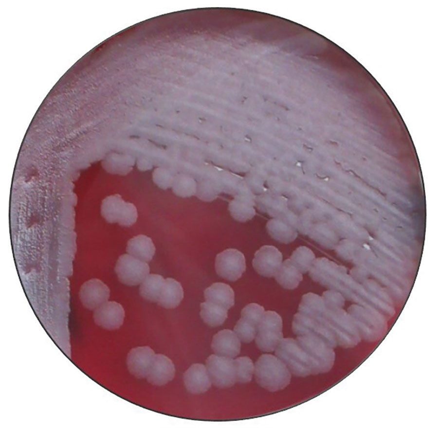 Bacillus anthracis 24-hour growth on sheep blood agar from a swab of a cutaneous anthrax lesion from a patient in Texas, USA, 2019. Typical ground glass colony morphology and lack of hemolysis are shown.