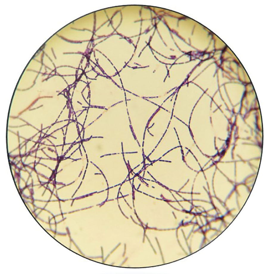 Gram stain from culture of a lesion of an anthrax patient, Texas, USA, 2019.
