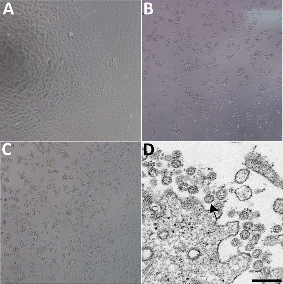 Cytopathic effect caused by severe acute respiratory syndrome coronavirus 2 from patient with 2019 novel coronavirus disease, United States, 2020. A–C) Phase-contrast microscopy of Vero cell monolayers at 3 days postinoculation: A) Mock, B) nasopharyngeal specimen, C) oropharyngeal specimen. Original magnifications ×10). D) Electron microscopy of virus isolate showing extracellular spherical particles with cross-sections through the nucleocapsids (black dots). Arrow indicates a coronavirus virio
