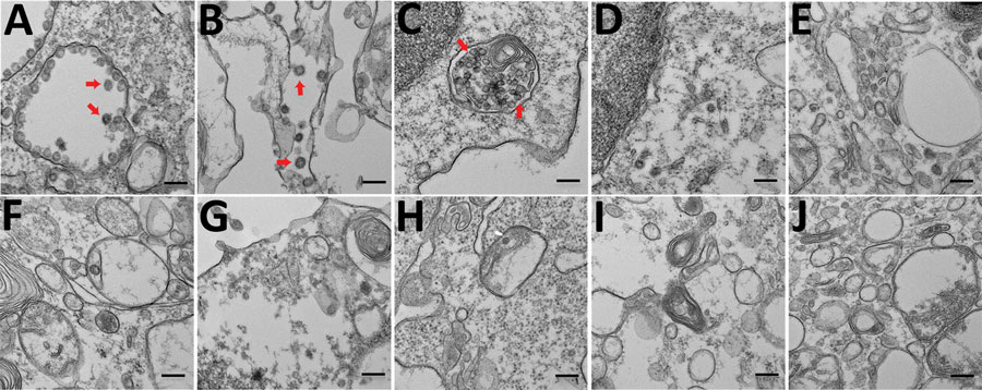 Electron micrographs of severe acute respiratory syndrome coronavirus 2 (SARS-CoV-2)–infecting cells. To detect coronavirus-like particles in experimentally infected human structural and immune cells, we infected a range of cells with SARS-CoV-2 at a multiplicity of infection of 0.01 for 48 h. The cells were fixed, processed, and imaged by using a transmission electron microscope (10 fields/cell type). A representative image of each cell type is shown. Virus-like particles are indicated by red a