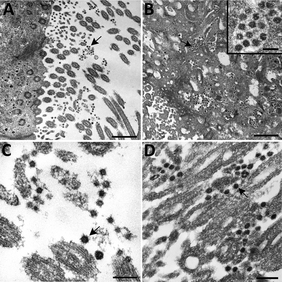 Ultrastructural features of severe acute respiratory syndrome coronavirus 2 infection within the upper airway of a fatal coronavirus disease case from formalin-fixed paraffin-embedded (FFPE) tissue. Viral particles associated with the cilia of ciliated cells (A, C, and D) and the cytoplasm of respiratory epithelial cells (B) in the upper airway are indicted by arrows. Images in panels A and C were obtained from FFPE tissue removed from a paraffin block using a 2-mm biopsy punch. Images in panels