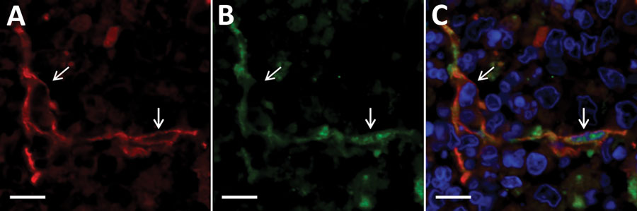 Double-labeling immunofluorescent staining of the thymus from fatal cases severe fever with thrombocytopenia syndrome (SFTS) in cats, Japan. Arrows indicate thymic epithelial cells. A, D) Red indicates signals of cytokeratin. B, E) Green indicates signals of SFTS virus. C, F) Blue indicates nuclei labeled with DAPI. Scale bars indicate 10 μm.