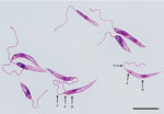 Cultured Leishmania promastigotes of the strain isolated from a patient in Arizona, USA. Morphologic features include a slender elongated body that contains a kinetoplast (K) anterior to the nucleus (N) and flagellum (F). The parasite had a total body length of ≈15 μm. Giemsa-stained; scale bar indicates 10 μm.