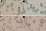 Thin blood film photographs showing Babesia-like early tetrads (panels A, B) and pleiomorphic later-stage parasites (panels C, D) in an HIV-positive patient from Zimbabwe living in South Africa. The multiply infected erythrocytes and unusual morphology suggested nonmalaria parasites and were later determined to be the rodent piroplasm Anthemosoma garnhami, related to Babesia spp. Slides stained with 10% Giemsa, pH 7.2, for 20 min; original magnification ×1,000.