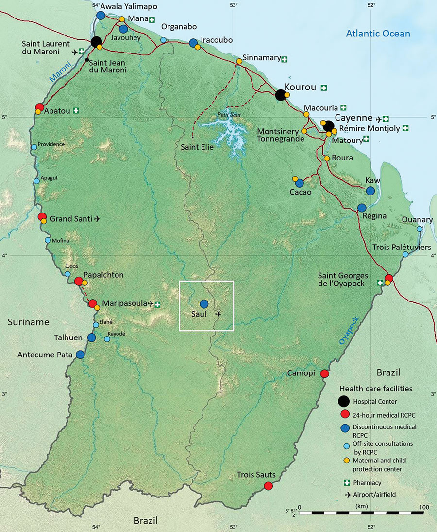 Locations of the town of Saül and 17 remote centers for prevention and care in French Guiana. Black circles: hospital centers; red circles: 24-hour remote centers for prevention and care; dark blue circles: remote centers for prevention and care (not 24-hour); light blue circles: off-site consultations with remote center for prevention and care; orange circles: maternal and child protection centers. Source: Dr. Elise Martin, Centre Hospitalier de Cayenne, French Guiana.