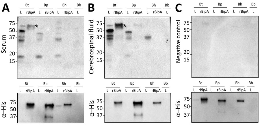 Immunoblots assessing antibody responses to Borrelia protein lysates and rBipA in samples from a patient in Texas, USA, and a control sample. A, B) Serum (A, upper panel) and cerebrospinal fluid (B, upper panel) samples were used to detect reactivity to Borrelia protein lysates and to rBipA from each species of tickborne relapsing fever spirochete. C) Negative human serum sample (upper panel) and immunoblots (bottom panel) that were reprobed with a monoclonal antibody for the histidine residues fused on the N terminus of each recombinant protein. Asterisks (*) indicates rBipA, which is ≈65 kDa. Molecular masses in kDa are indicated on the left of each immunoblot. Bb, Borreliela (Borrelia) burgdorferi; Bh, B. hermsii; BipA, Borrelia immunogenic protein A; Bp, B. parkeri; Bt, B. turicatae; rBipA, recombinant BipA.