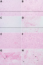 Patterns of histopathology and immunohistopathology in brains from 2 raccoons inoculated with the agent of chronic wasting disease (CWD). Panels A, C, E, and G show results for raccoon 2, inoculated with the agent of CWD from white-tailed deer; panels B, D, F, and H) show results for raccoon 9, inoculated with CWD from a vole that had been inoculated with the 4th vole-passage of the agent of CWD from white-tailed deer. All images original magnification ×20. A–D) Medulla at the level of the obex. A) Raccoon 2 shows no spongiform change in the dorsal motor nucleus of the vagus nerve (DMNV) (above dashed line) or hypoglossal nucleus (below dashed line). Hematoxylin and eosin (H&E) stain. B) Raccoon 9 shows mild to moderate spongiform change in the DMNV. H&E stain. C) Raccoon 2 shows very mild PrPSc immunoreactivity in the DMNV and no immunoreactivity in neurons of the hypoglossal nucleus. PrP antibodies F89/160.1.5 and F99/97.6.1. D) Raccoon 9 shows moderate PrPSc immunoreactivity in the neuropil of the DMNV and marked intraneuronal immunoreactivity in the hypoglossal nucleus. PrP antibodies F89/160.1.5 and F99/97.6.1. E–H) Caudate nucleus. E) Raccoon 2 shows moderate diffuse spongiform change. H&E stain. F) Raccoon 9 shows marked diffuse spongiform change. H&E stain. G) Raccoon 2 shows diffuse neuropil PrPSc immunoreactivity and prominent extracellular PrPSc accumulation on neurons (arrowheads). PrP antibodies F89/160.1.5 and F99/97.6.1. H) Raccoon 9 shows marked intracellular PrPSc immunoreactivity in neurons (arrowheads) and glial cells (arrows). PrP antibodies F89/160.1.5 and F99/97.6.1.