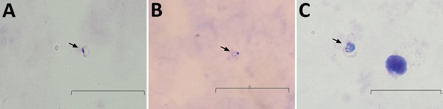 Micrographs of the thick blood smears showing Plasmodium trophozoites in 2 human cases of Plamodium inui infection, Malaysia. A) Smear from case-patient PMAR0041, taken by using an Olympus BX51 microscope (Olympus Corporation, https://www.olympus-lifescience.com). B) Smear from case-patient PMAR0041, taken by using Redmi Note 4 (Xiaomi Corporation, https://www.mi.com) smartphone camera. C) Smear from case-patient PMAR0052, taken by using an Olympus BX51 microscope. Arrows indicate P. inui trophozoites in each image. Scale bars indicate 20 µm.