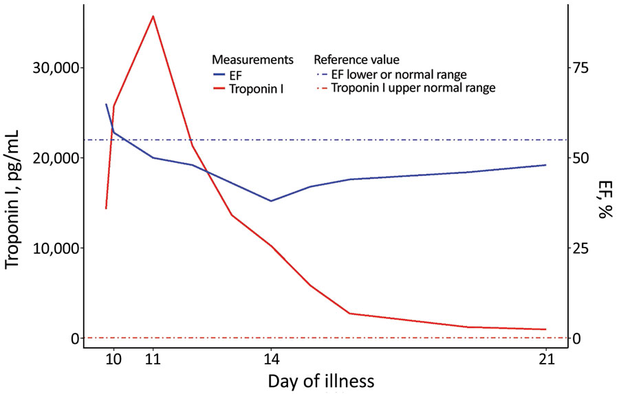 Temporal changes in troponin I levels and ejection fraction measurements during the acute phase of diphtheria myocarditis in a 7-year-old boy, Vietnam, 2020. EF, ejection fraction.