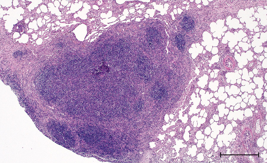 Histopathologic features in red deer in case 2 in study of tuberculosis caused by Mycobacterium microti in red deer, Austria and Germany. Lung tissue highly infiltrated by round cells, predominantly lymphocytes and some macrophages, single multinucleated Langhans-type giant cells, hematoxylin and eosin stain. Scale bar = 500 μm.