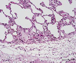 Histopathologic features in red deer in case 3 in study of tuberculosis caused by Mycobacterium microti in red deer, Austria and Germany. Lung tissue with granulocytic infiltration and some multinucleated Langhans-type giant cells, hematoxylin and eosin stain. Scale bar = 100 μm.